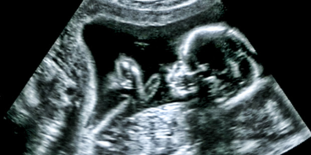South Carolina Supreme Court Allows for More Late-Term Abortions in Devastating Ruling